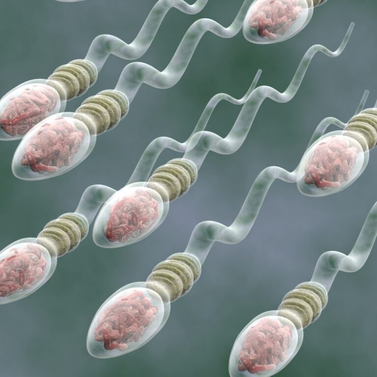 oligozoospermia